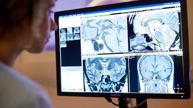Магнитный резонанс в научно-клинической практике исследований черепно-мозговой травмы