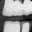 012 teeth num 1-30 X22012_3.jpg