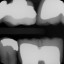 010 teeth num 12-19 X22012_2.jpg