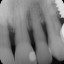 016 teeth num 8-9 X22012_1.jpg